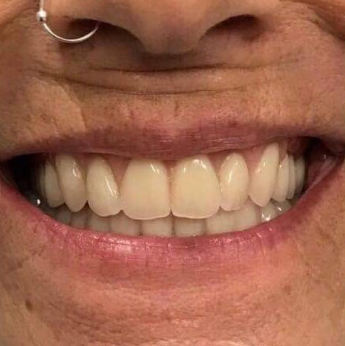 1000116251